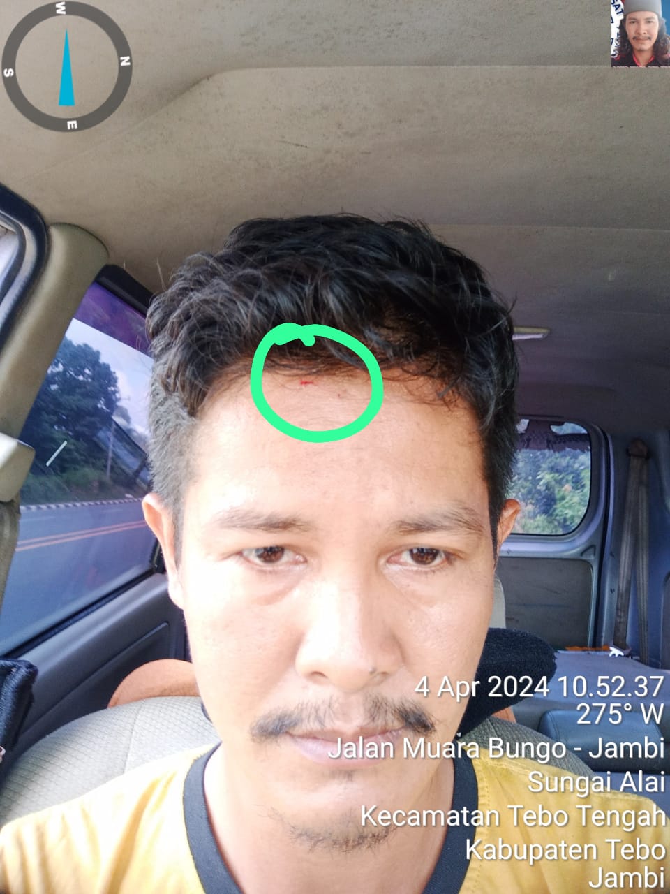 Korban Penganiayaan di SPBU SPBU 24-375-82 Desak Polres Tebo Segera Tangkap Pelakunya